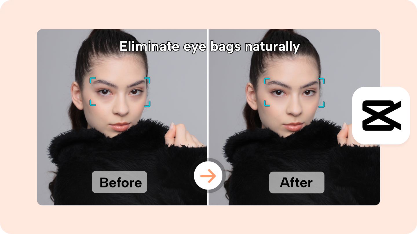 How to Get Rid of Eye Bags Naturally? Safe and Effective Remedies 