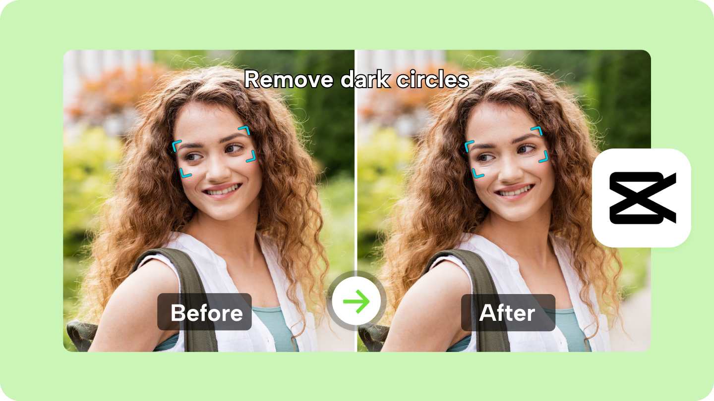 Comment puis-je supprimer les cernes de façon permanente? Moyens rapides et efficaces 