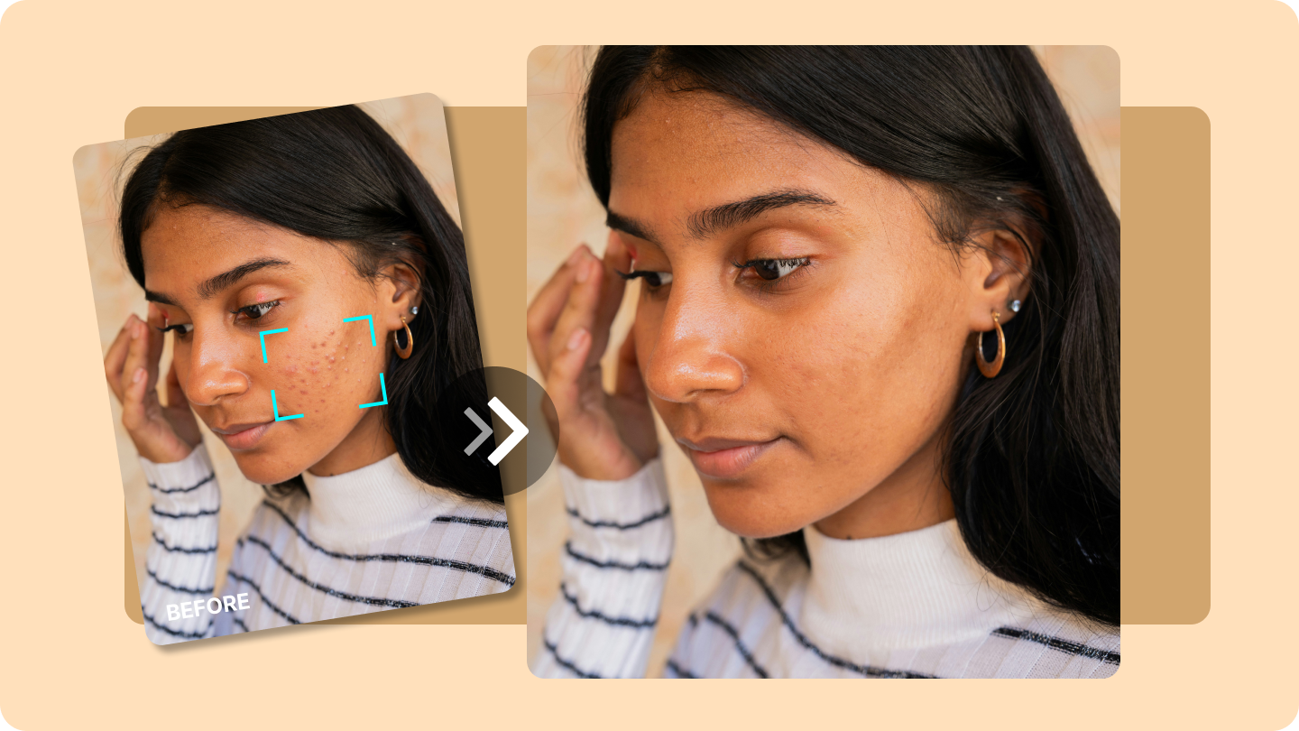  keluarkan jerawat dari foto